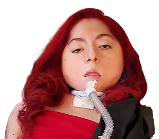 Connie is currently living with TK2d.